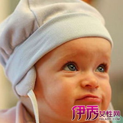 早产儿黄疸图片|life.yxlady.com