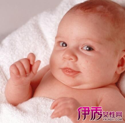 三个月婴儿脸上有白斑|life.yxlady.com
