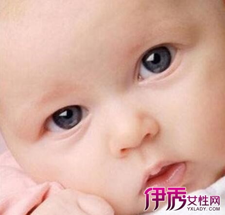 4岁宝宝眼睛有血丝|life.yxlady.com