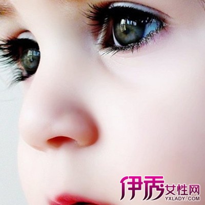 【图】小孩子眼睛发红是怎么回事 盘点引起宝宝红眼睛的7大原因