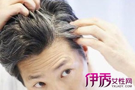 才<em>20岁</em>为什么长<em>白头发</em>|life.yxlady.com-伊秀生活
