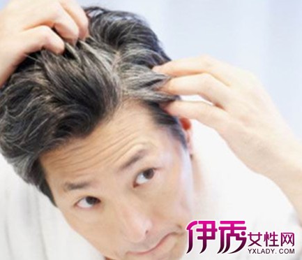 吃什么防止<em>长白头发</em>|life.yxlady.com-伊秀生活小