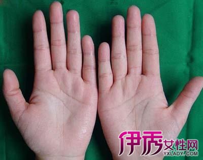 手心出汗是什么原因|life.yxlady.com