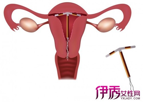 取环的最佳时间|life.yxlady.com