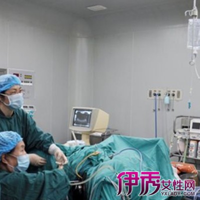 微创性妇科诊疗技术,用于子宫腔内检查和治疗的一种纤维光源内窥镜