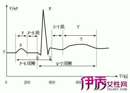 【图】心电图波形解释 生命跳动的曲线