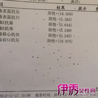 【图】乙肝对照表的图片大全欣赏 关于病情的9种检查结果分析