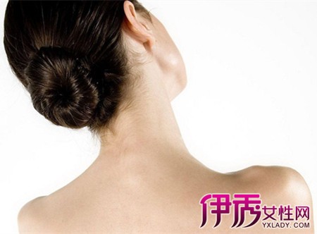 背部痤疮|life.yxlady.com-伊秀生活小常识