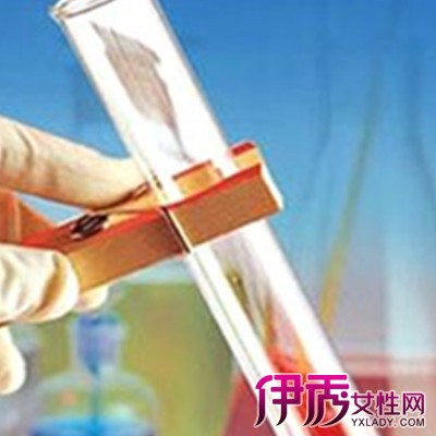 总胆汁酸高的危害|life.yxlady.com-伊秀生活小常