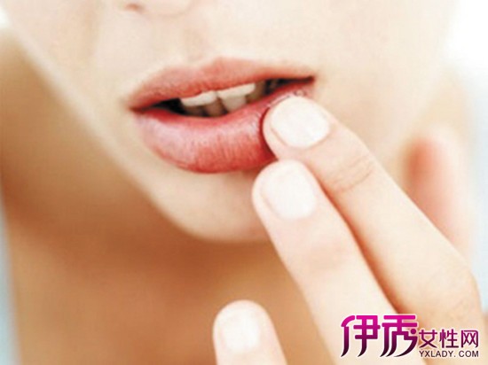 嘴唇疱疹的治疗方法|life.yxlady.com