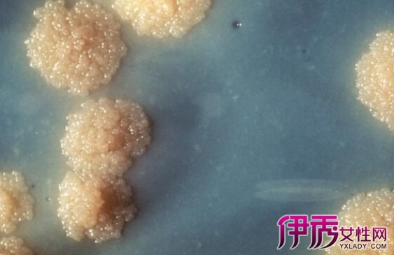 梅毒口腔症状|life.yxlady.com