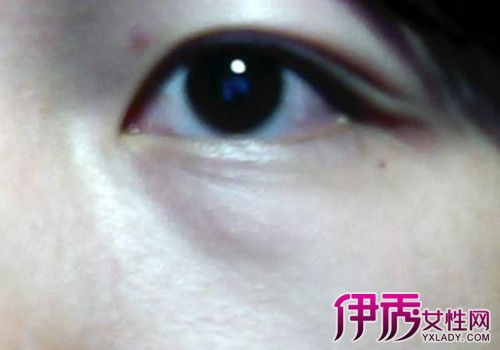 白色分泌物,俗名叫"眼屎",一般情况下,是眼睛"上火"的表现,偶尔出现