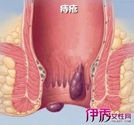 【图】肛门潮湿有异味怎么办 弄清原因才能对症下药
