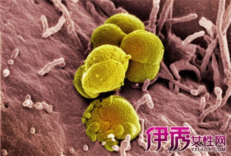 淋病的治疗方法|life.yxlady.com