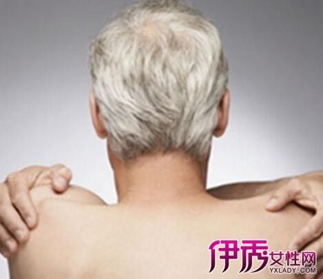 16岁长白头发的原因|life.yxlady.com