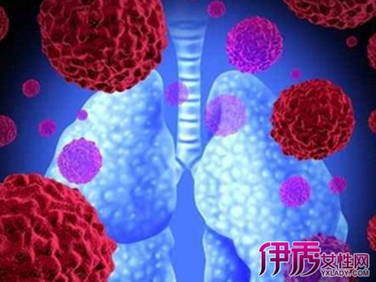 早期肺癌能活多久|life.yxlady.com