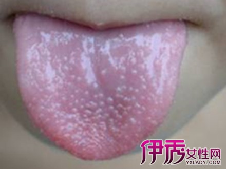 多肉根上长了很多瘤子怎么办