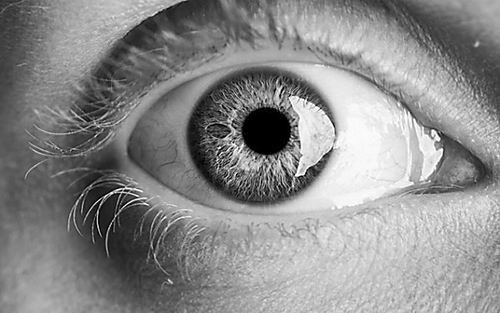 【图】大曝光瞳孔放大图片 揭秘造成此症状的原因