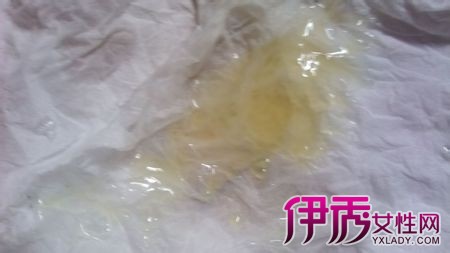 【图】揭秘精子发黄正常吗 男性健康出问题的暗示