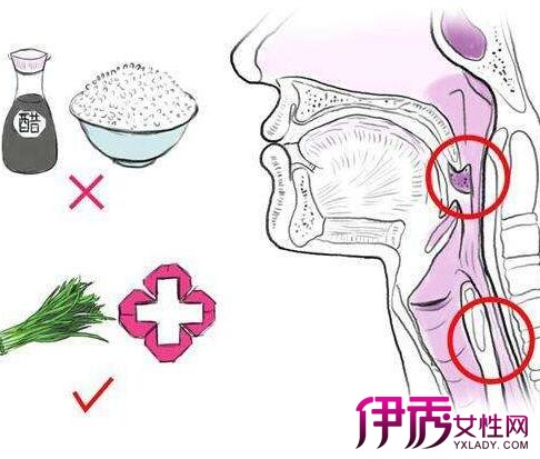 食道炎癌的早期症状|life.yxlady.com