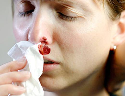 鼻癌的早期症状图|life.yxlady.com